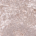 Immunohistochemical staining of human tonsil shows moderate nuclear positivity in non-germinal center cells.