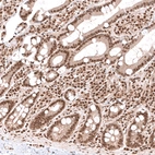 Immunohistochemical staining of human duodenum shows moderate to strong nuclear positivity in glandular cells.