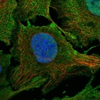 Immunofluorescent staining of human cell line U-2 OS shows localization to nucleoplasm & plasma membrane.