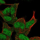 Anti-DMAP1 Antibody