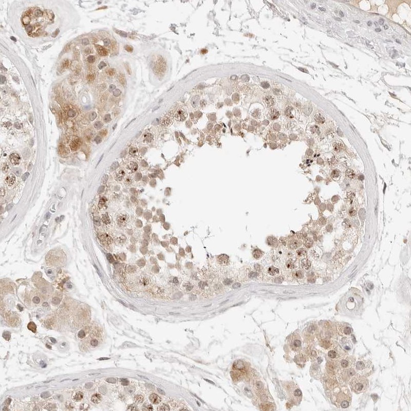 Anti-C17orf47 Antibody
