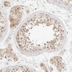 Anti-C17orf47 Antibody
