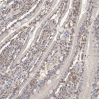Immunohistochemical staining of human duodenum shows weak to moderate cytoplasmic positivity in lymphoid cells.