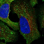 Immunofluorescent staining of human cell line U-2 OS shows localization to cytosol & vesicles.