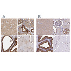 Immunohistochemical staining of human cerebral cortex, kidney, prostate and skeletal muscle using Anti-TPD52 antibody HPA028427 (A) shows similar protein distribution across tissues to independent antibody HPA062167 (B).