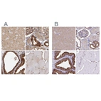 Immunohistochemical staining of human cerebral cortex, kidney, prostate and skeletal muscle using Anti-TPD52 antibody HPA028427 (A) shows similar protein distribution across tissues to independent antibody HPA062167 (B).