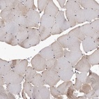 Immunohistochemical staining of human skeletal muscle shows low expression as expected.