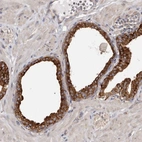 Immunohistochemical staining of human prostate shows high expression.