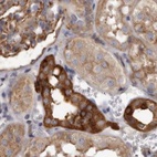 Anti-TPD52 Antibody