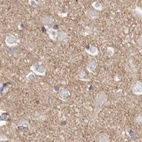 Immunohistochemical staining of human cerebral cortex using Anti-TPD52 antibody HPA028427.