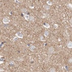 Anti-TPD52 Antibody