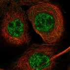 Immunofluorescent staining of human cell line A-431 shows localization to nucleoplasm & cytosol.