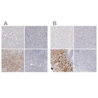 Immunohistochemical staining of human liver, pancreas, prostate and tonsil using Anti-LMOD1 antibody HPA028435 (A) shows similar protein distribution across tissues to independent antibody HPA028325 (B).