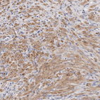 Immunohistochemical staining of human prostate shows moderate cytoplasmic positivity in smooth muscle cells.