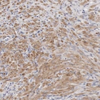Immunohistochemical staining of human prostate shows moderate cytoplasmic positivity in smooth muscle cells.