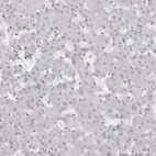 Immunohistochemical staining of human liver shows no positivity in hepatocytes as expected.