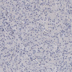 mmunohistochemical staining of human pancreas shows no positivity in exocrine glandular cells as expected.
