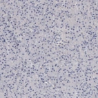 mmunohistochemical staining of human pancreas shows no positivity in exocrine glandular cells as expected.