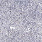 Immunohistochemical staining of human tonsil shows no positivity in non-germinal center cells as expected.