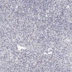 Immunohistochemical staining of human tonsil shows no positivity in non-germinal center cells as expected.