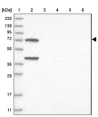 Lane 1: Marker [kDa] 230, 130, 95, 72, 56, 36, 28, 17, 11_br/_Lane 2: Human cell line RT-4_br/_Lane 3: Human cell line U-251MG sp_br/_Lane 4: Human plasma (IgG/HSA depleted)_br/_Lane 5: Human liver tissue_br/_Lane 6: Human tonsil tissue