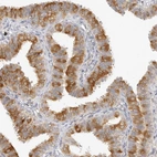 Immunohistochemical staining of human fallopian tube shows moderate cytoplasmic positivity in glandular cells.