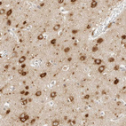 Immunohistochemical staining of human cerebral cortex shows moderate to strong cytoplasmic positivity in neuronal cells.
