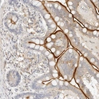 Immunohistochemical staining of human colon shows moderate to strong positivity in apical membrane in glandular cells.