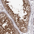 Anti-MED8 Antibody