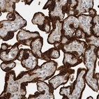 Anti-YOD1 Antibody