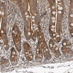 Immunohistochemical staining of human duodenum shows strong cytoplasmic positivity in glandular cells.