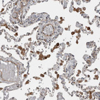 Immunohistochemical staining of human lung shows strong cytoplasmic positivity in macrophages.