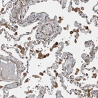Immunohistochemical staining of human lung shows strong cytoplasmic positivity in macrophages.