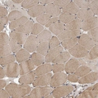 Immunohistochemical staining of human skeletal muscle shows moderate cytoplasmic positivity in myocytes.