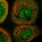 Immunofluorescent staining of human cell line A-431 shows localization to nucleoplasm, plasma membrane & cytosol.