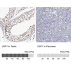 Anti-USP1 Antibody