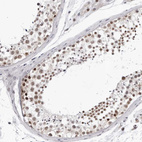 Immunohistochemical staining of human testis shows moderate nuclear positivity in cells in seminiferous ducts.
