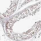 Immunohistochemical staining of human testis shows moderate nuclear positivity in cells in seminiferous ducts.