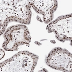 Immunohistochemical staining of human placenta shows strong nuclear positivity in trophoblastic cells.