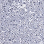 Immunohistochemical staining of human pancreas shows no positivity in exocrine glandular cells as expected.
