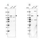 Western blot analysis using Anti-USP1 antibody HPA028440 (A) shows similar pattern to independent antibody HPA028387 (B).