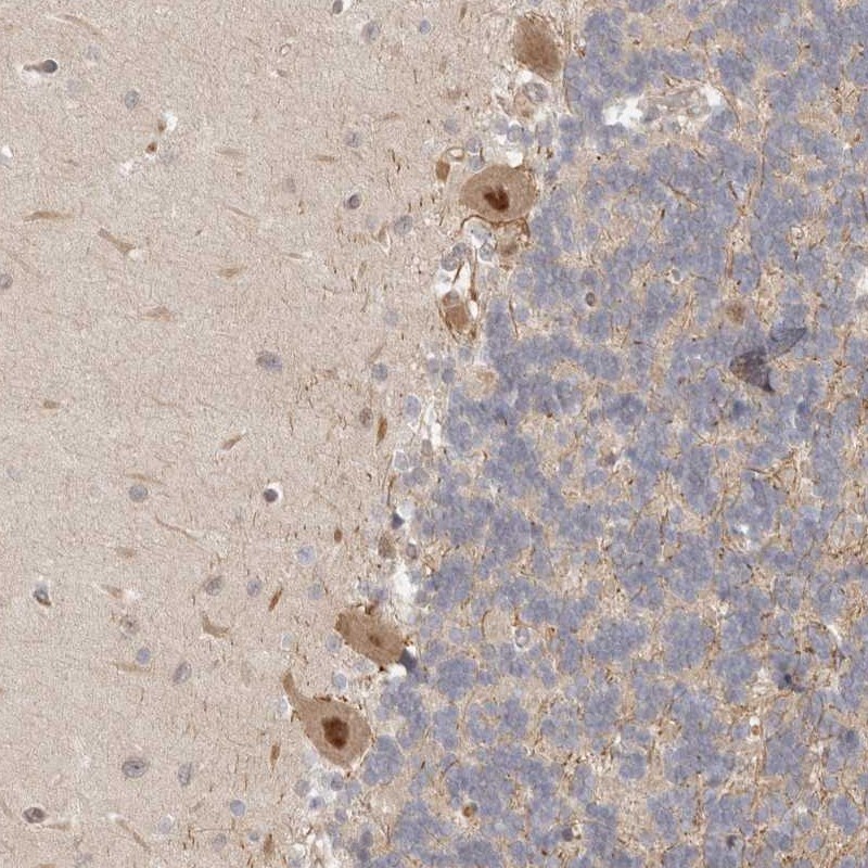 Anti-PSMA5 Antibody