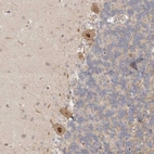 Anti-PSMA5 Antibody