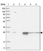 Lane 1: Marker [kDa] 230, 130, 95, 72, 56, 36, 28, 17, 11_br/_Lane 2: Human cell line RT-4_br/_Lane 3: Human cell line U-251MG sp_br/_Lane 4: Human plasma (IgG/HSA depleted)_br/_Lane 5: Human liver tissue_br/_Lane 6: Human tonsil tissue