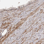 Immunohistochemical staining of human prostate shows moderate cytoplasmic positivity in smooth muscle cells.