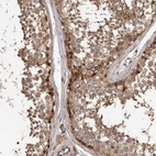 Immunohistochemical staining of human testis shows moderate cytoplasmic positivity in cells in seminiferous ducts.