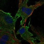 Immunofluorescent staining of human cell line BJ shows localization to plasma membrane & vesicles.