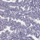 Immunohistochemical staining of human endometrium shows no positivity in glandular cells as expected.