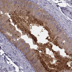 Immunohistochemical staining of human epididymis shows moderate cytoplasmic and membranous positivity in glandular cells.