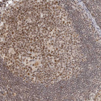 Immunohistochemical staining of human lymph node shows moderate nuclear positivity in germinal center cells.